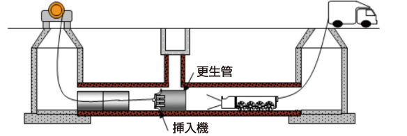 更生管挿入工