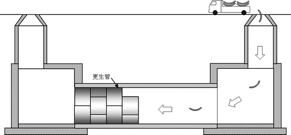 更生管挿入工