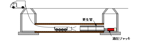 更生管挿入工